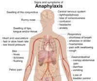 Anaphyaxis